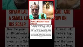 A Man Grew a Real Horn on His Head After an Injury 😳🔥