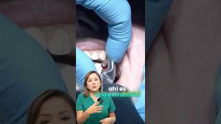 🛑 Dra. Tania reacciona: ¿Cuándo un diente ya no tiene salvación? 🤔👇 #odontologia #sonrisasegura