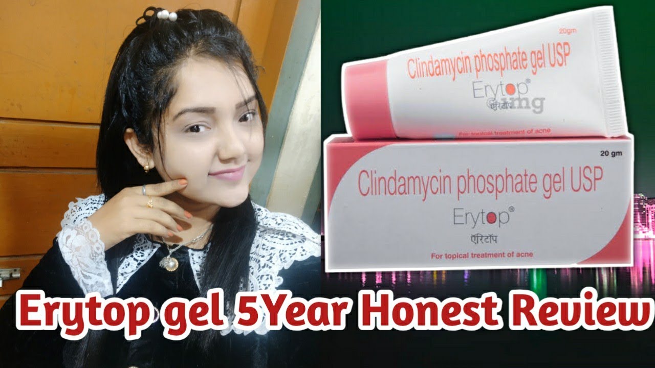 Erytop Cream Review in Hindi Best Cream for Acne Prone skin Erytop