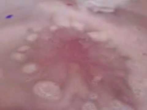 Champagne Supernova Bath Ballistic from Lush  - Bath Bomb