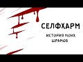 ИСТОРИЯ МОИХ ШРАМОВ