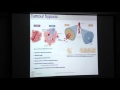 Modelling hypoxia activated prodrugs in vitro and in silico