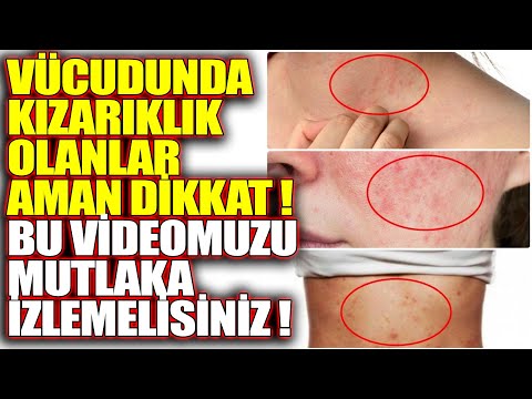 Video: Eski ampullere ne ad verilir?