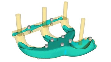 Sand Core Drying | FLOW-3D CAST