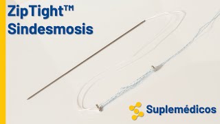ZipTight Sindesmosis