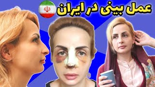 اومدم ایران دماغمو عمل کردم (ولاگ عمل بینی) Rhinoplasty in Iran🇮🇷