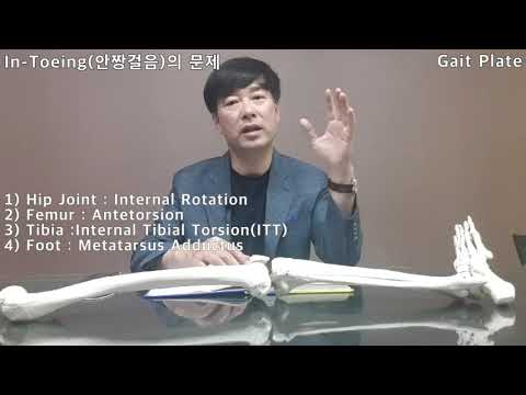 7회 - In Toeing안짱걸음의 문제
