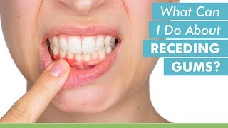 What Can I Do About Receding Gums?