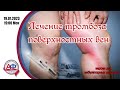 Лечение тромбоза поверхностных вен (версия для амбулаторных хирургов)