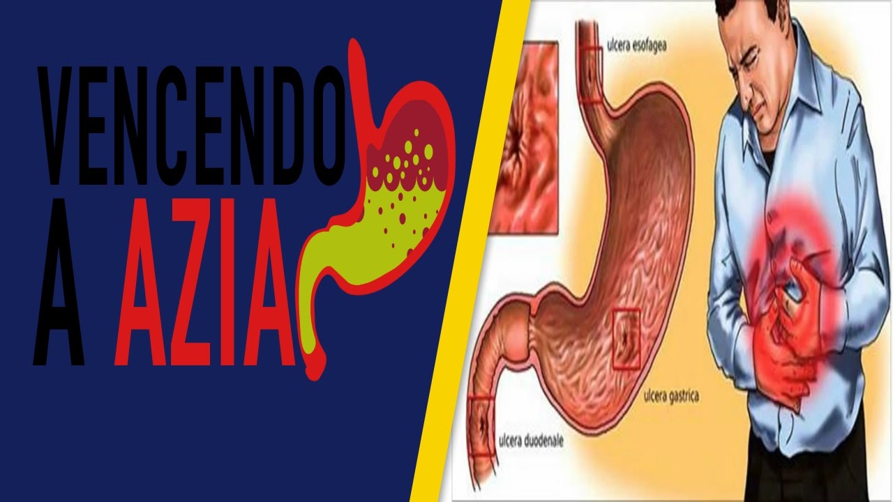 Como Curar Azia e Queimação de Maneira Natural - YouTube