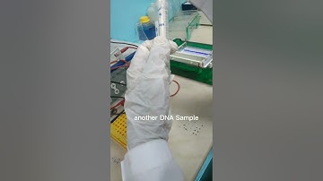 Gel Electrophoresis: DNA sample loading and UV visualization