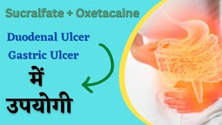 पेट में अल्सर के लिए syrup | gastric ulcer treatment | sucrafil o gel | duodenal ulcer.