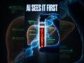 AI Blood Test Finds Disease Before Symptoms #ainews