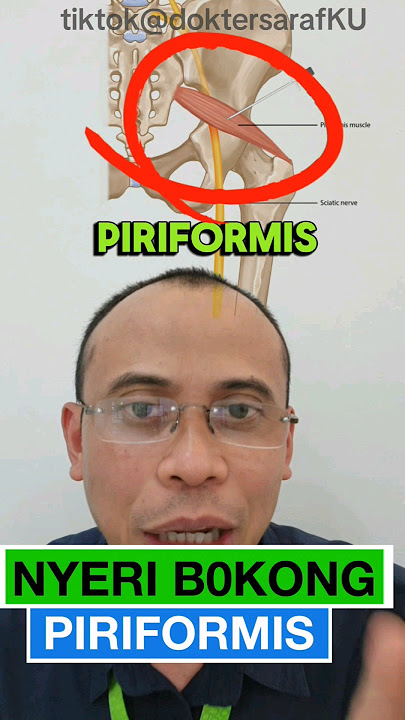 Kenali Gejala Awal Piroformis Sindroma, Nyeri Bokong Mirip Saraf Kejepit Pinggang.