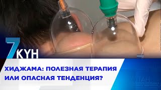 Хиджама: полезная терапия или опасная тенденция?