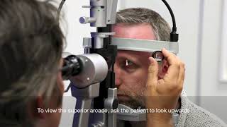 Slit Lamp set-up and fundal assessment with a 90d lens