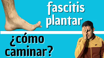 ¿Empeora la fascitis plantar al caminar?