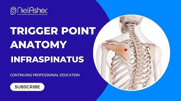 Exploring the Infraspinatus: Understanding Trigger Point Locations for Better Muscle Health
