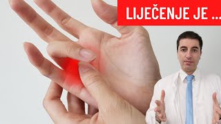 Škljocavi Prst Se Liječi Na Ovaj Način...