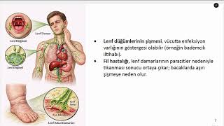 Enf Dolaşımı Nedir? Lenf Sistemi Nasıl Çalışır? Ödem, Bağışıklık