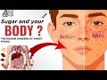Sugar and your body Explained | The hidden dangers in sweet foods | sugar and human body
