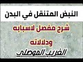 النبض المتنقل في البدن ما هي اسابه وما هي دلالاته شرح تفصيلي للنبض المتنقل الغريب الموصلي النبض المتنقل في البدن ما هي اسابه وما هي دلالاته شرح تفصيلي للنبض المتنقل الغريب الموصلي