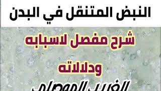 النبض المتنقل في البدن ( ما هي اسابه وما هي دلالاته ) شرح تفصيلي للنبض المتنقل الغريب الموصلي