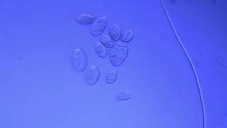 Ciliates interacting - Foldscope Gallery