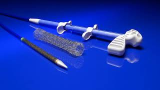 Introducing the EndoMAXX Esophageal Stent