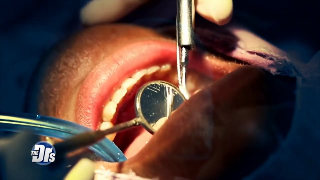 Dental Therapists: Help or Hazard?