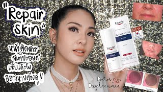 "Repair Skin" ผิวแพ้ง่าย หน้า​ติดสารสเตียรอยด์​ เซบเดิร์ม อยากหายต้องดู!! | DOCTOR​ DAYDREAMER