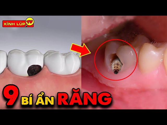 🔥 9 Bí Ẩn Ly Kỳ và Thú Vị Về Răng Ở Ngay Trong Miệng Mà Chưa Chắc Bạn Đã Biết | Kính Lúp TV