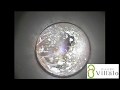 耳掃除 vol.2 「奥に隠された耳垢」(ear wax removal)イヤーエステサロンVillalo～ヴィラロ～