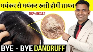 भयंकर से भयंकर रूसी होगी गायब | Get Rid Of Dandruff at Home | Remove Dandruff Naturally