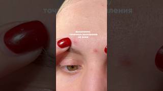 Убрала высыпания и точечные воспаления на коже