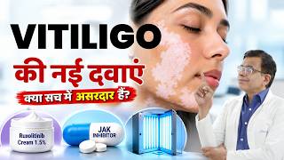 Latest Vitiligo Treatment 2026 | Ruxolitinib Cream, JAK Inhibitors & New Medicines