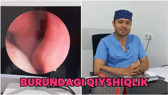 Yashirin kameraga siyayotgan ayollar Osmirlar porno onlayn HD formatda