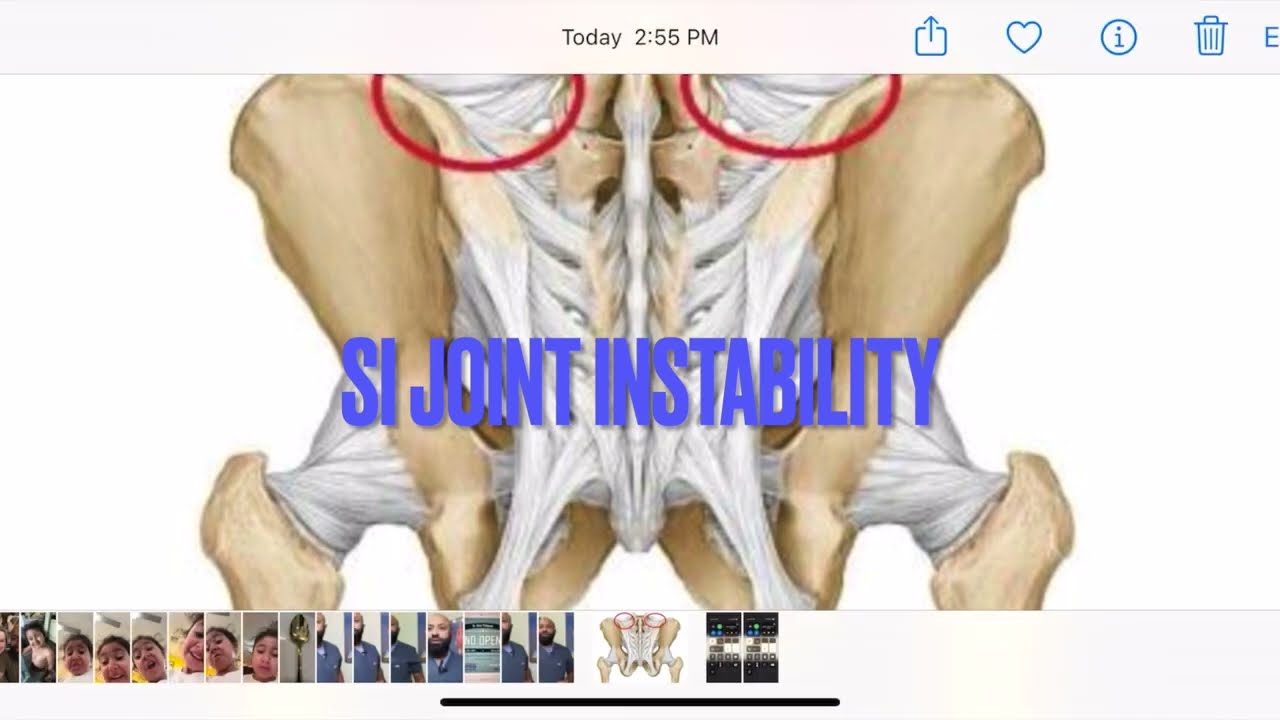 Si Joint Instability and Prolotherapy
