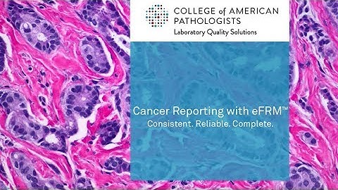 Cancer Reporting with eFRM