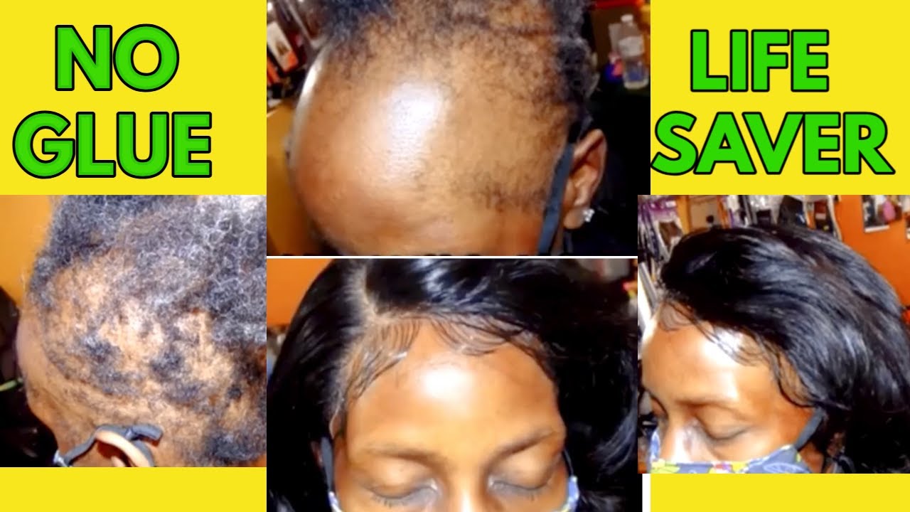 This Method Saved Her Edges From Breaking- Before and After Will Surprise You