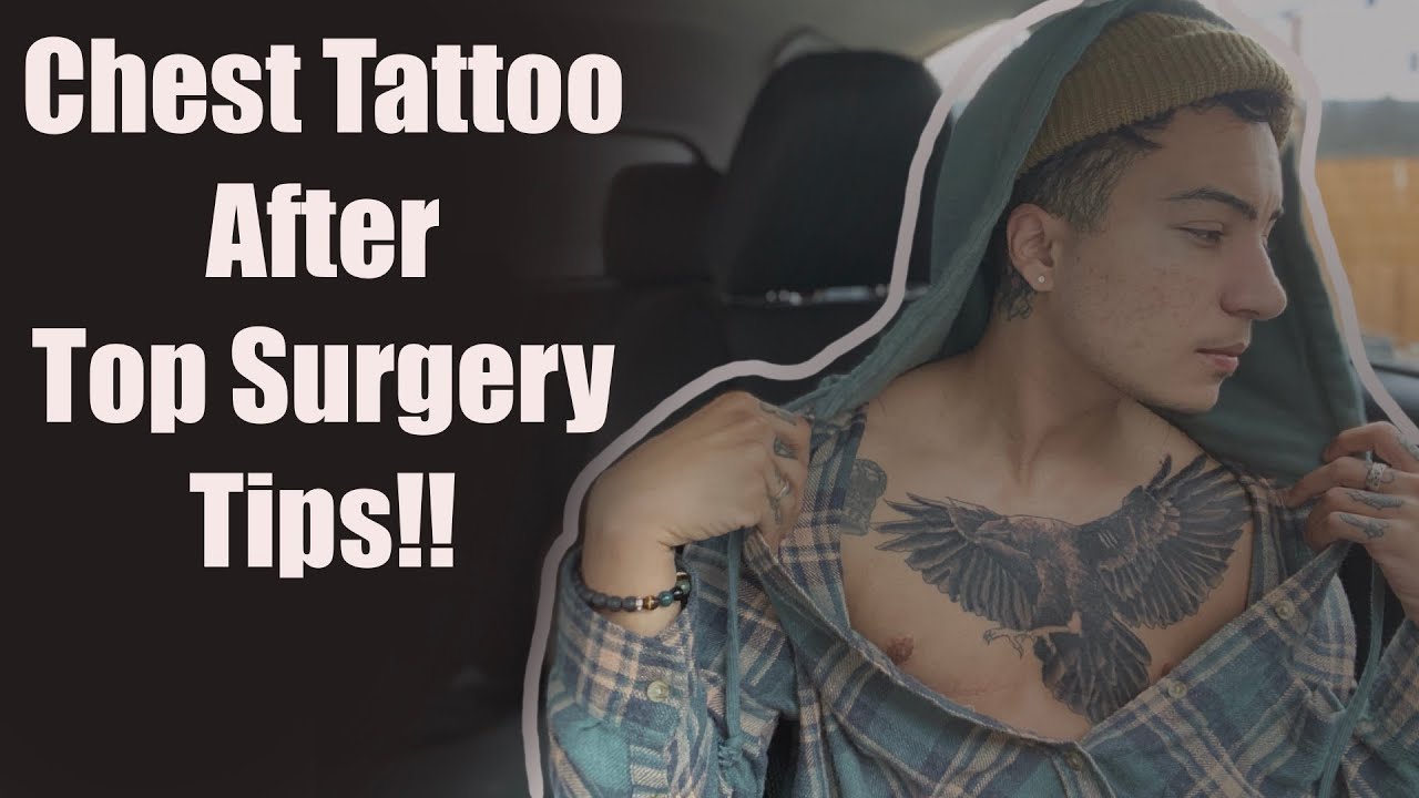 Trans Top Surgery Tattoos  Paradise Tattoo Studio Cheltenham  Gloucestershire