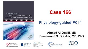 Case 166: Manual of PCI - Physiology-guided PCI 1