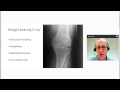 Surgical Management of the Arthritic Knee