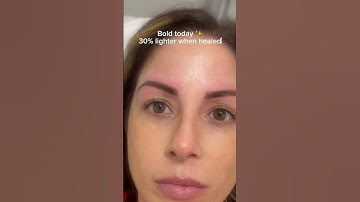 Brow correction -MicroBlading gone bad?? How to fix bad brows? #microbladingtreatment #microblading