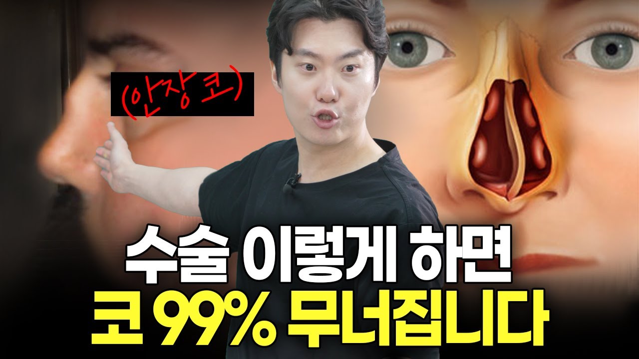 코수술 후 코 무너지는 사람 특징 (feat. 안장코)
