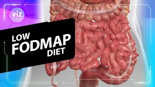 The Low Fodmap Diet What It Helpsand Its Limits