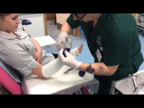 Application scaphoid cast