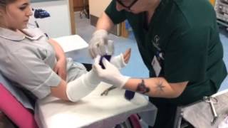 Application scaphoid cast