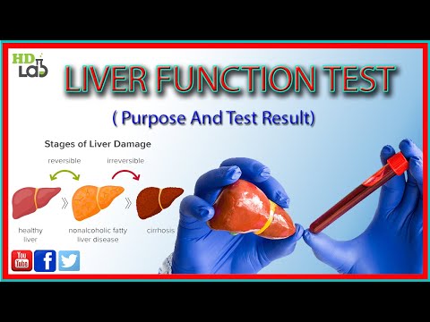 How To Liver Function Tests # ( ALT, AST, ALP ) Is your Liver in SERIOUS TROUBLE?
