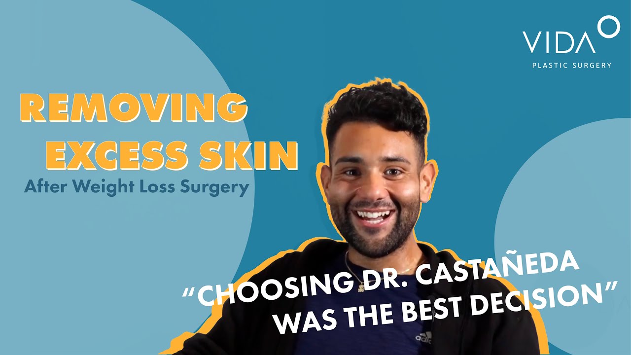 A Real Patient Story After 210lb Weight Loss Transformation Excess Skin Removal Youtube